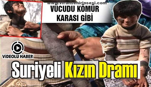 Urfa’daki Suriyeli Kızın Dram İçinde Dramı